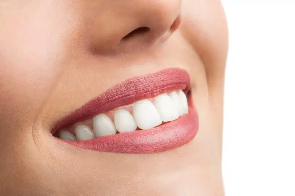 Clean teeth after teeth cleaning brownstown mi