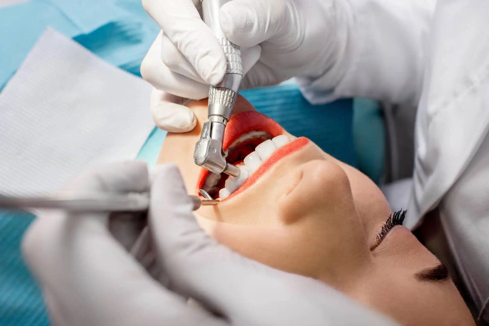 Teeth cleaning brownstown mi