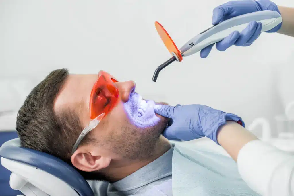 Teeth-whitening-by-dentist-in-woodhaven-mi
